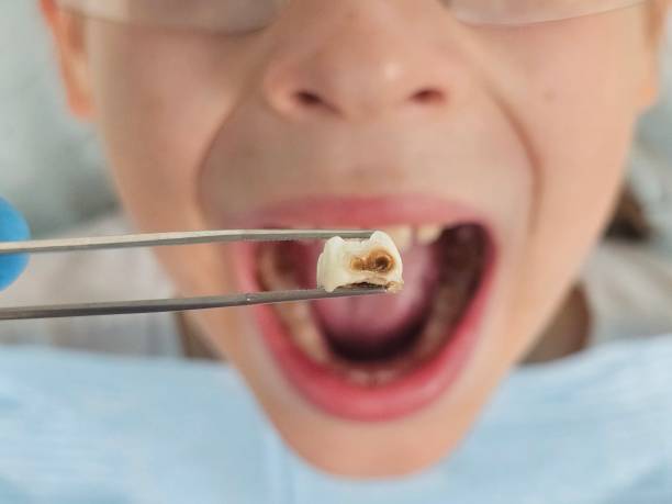 Best Emergency Care for Gum Disease in Pelican Marsh, FL